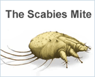 Scabies: Causes, Symptoms, Treatment - RemoteDerm